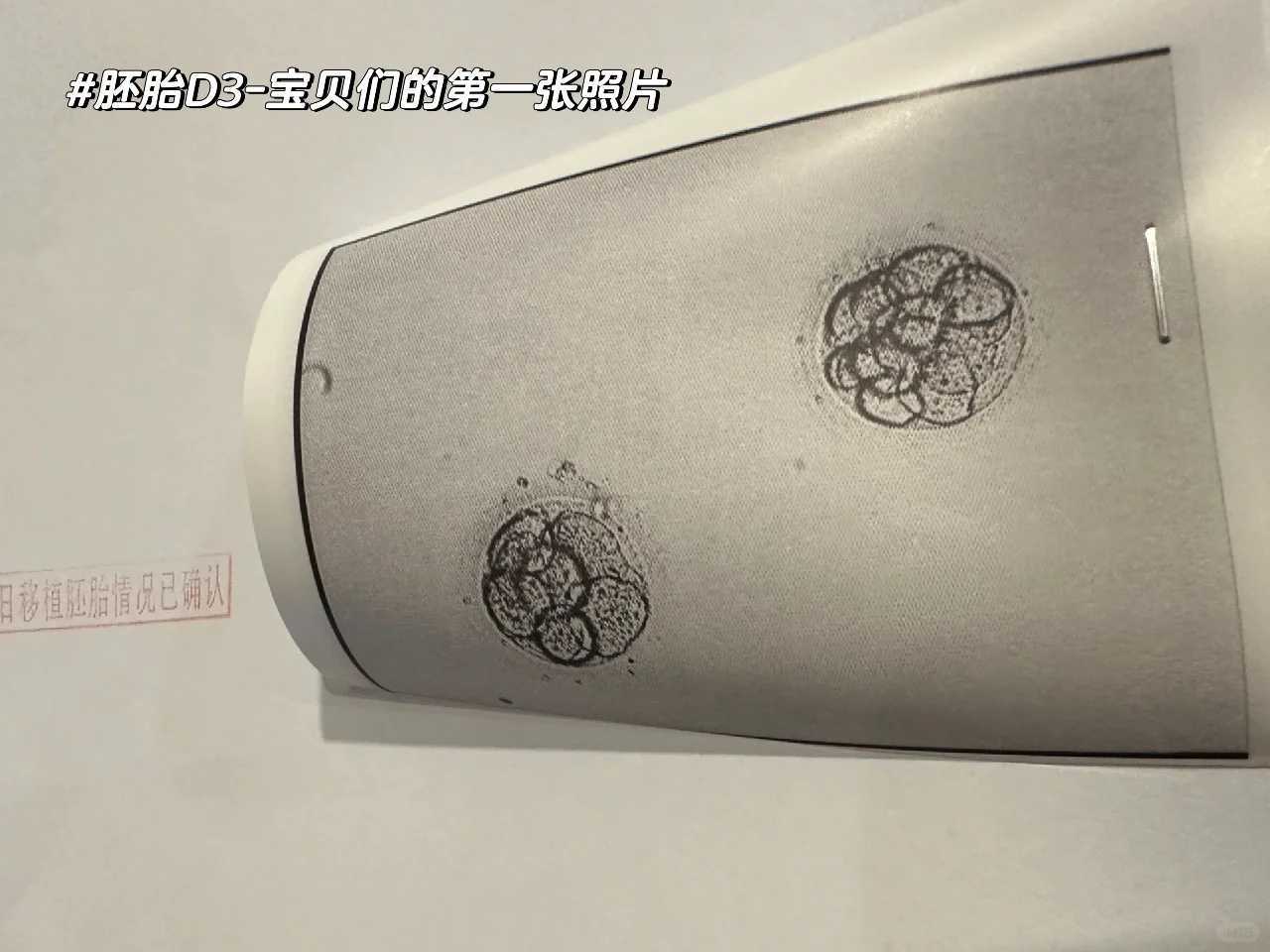 干细胞技术助力卵巢功能恢复：最新研究突破与展望